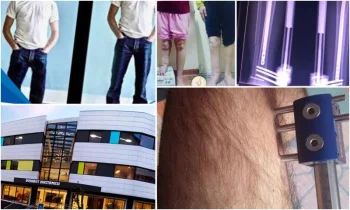 Türkiye'de Uzuv Uzatma -Limb Lengthening in Turkey