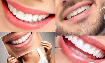 Diş Tasarımı - Dental Design Nasıl Olmalıdır?