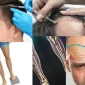 Hair Clinic Saç Kliniği