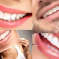 Diş Tasarımı - Dental Design Nasıl Olmalıdır?