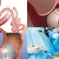 Gastrik Bypass Ameliyatı Hangi Durumlarda Önerilmez?